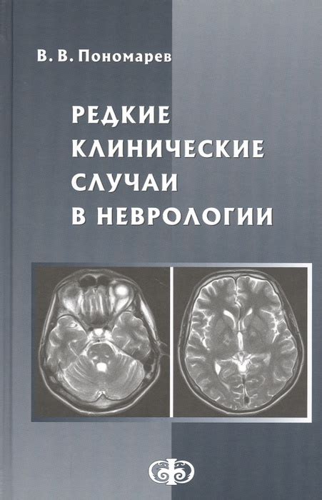 Редкие случаи задержки в дыхании