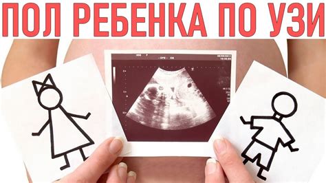 Роль мужчины в определении пола ребенка