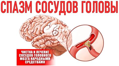 Роль стресса в возникновении спазмов и методы их снятия