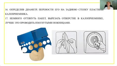 Самостоятельная смена и чистка калоприемника