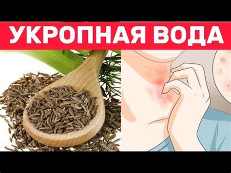 Секреты создания укропной воды