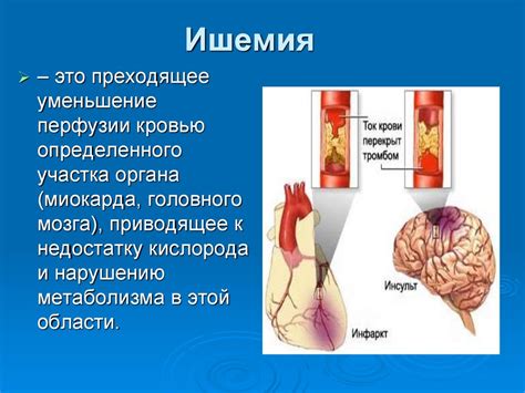 Сердечная ишемия и реполяризационные нарушения