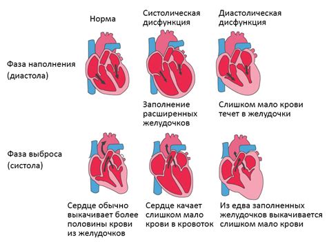 Сердечная недостаточность и дыхательные проблемы