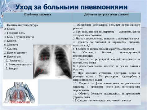 Симптомы воспаления белого вещества