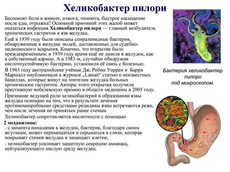 Симптомы заболевания хеликобактер пилори