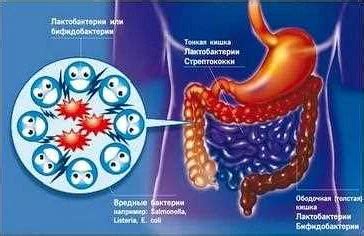 Симптомы и последствия воспаления микрофлоры