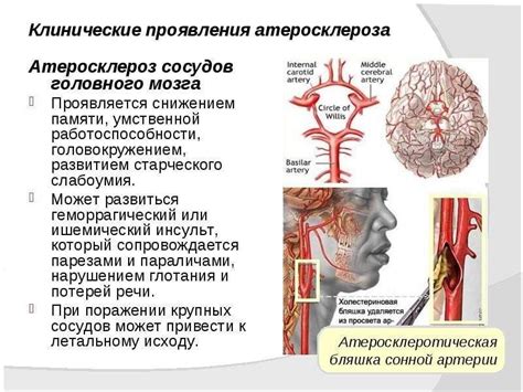 Симптомы и последствия проблем с сосудами головы и шеи