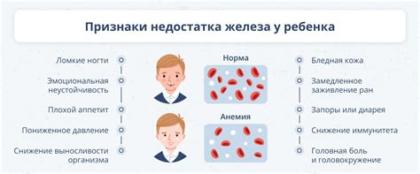 Симптомы и признаки железодефицитной анемии у детей