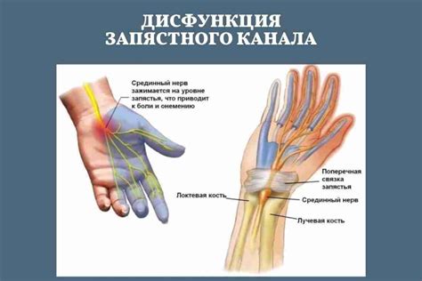 Симптомы и признаки защемления нерва в колене