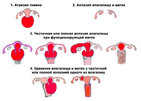 Симптомы и признаки плевы