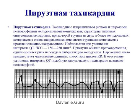 Симптомы и проявления аритмии и тахикардии