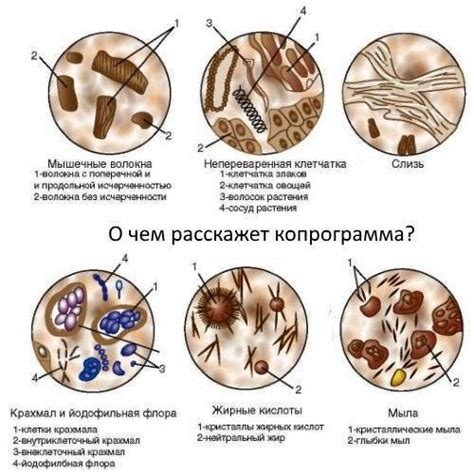 Симптомы наличия патологической йодофильной флоры в организме