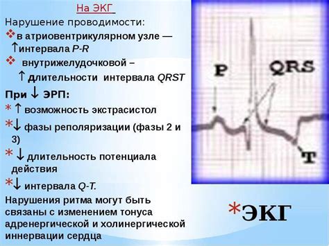 Симптомы нарушения внутрижелудочковой проводимости у ребенка