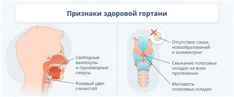 Симптомы осиплости голоса