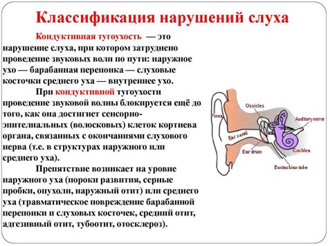 Симптомы тугоухости 2 степени