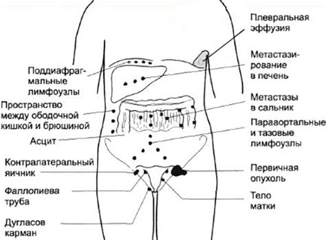 Симптомы шарика в паху у женщин