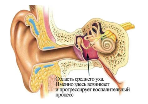 Симптом от воспаления среднего уха