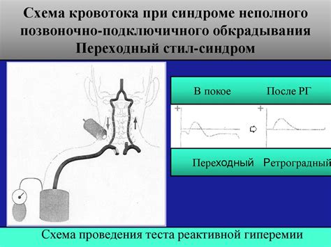 Синдром большого кровотока