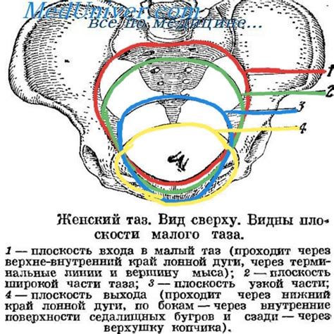 Синдром верхней полости таза