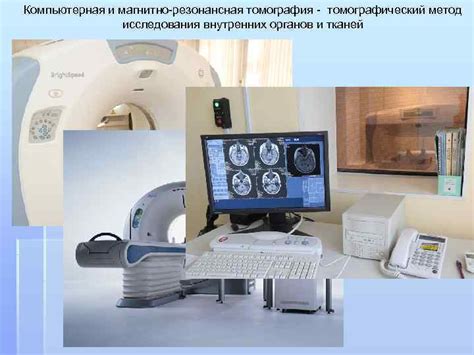 Скт - томография, значение и применение в медицине