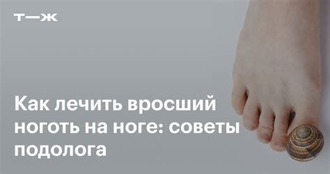 Смыслы сна: падающий ноготь на руке