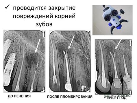 Снижение риска повреждений корней