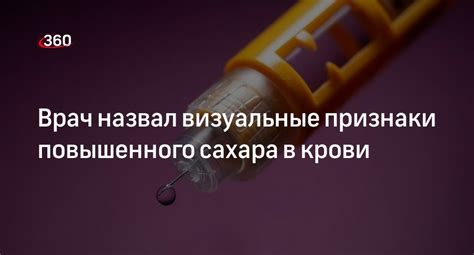 Снижение риска повышенного сахара в крови при приеме статинов