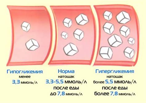 Снижение уровня сахара в крови