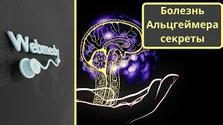 Советы по снижению риска укачивания на яхте