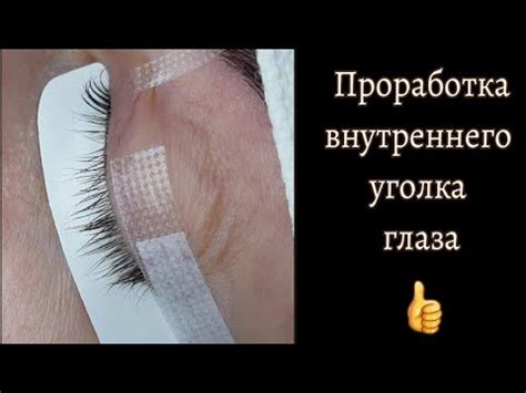 Советы по устранению зуда внутреннего уголка левого глаза