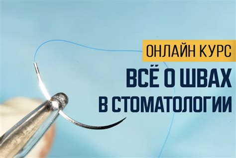 Современные новости о танталовых швах на легких