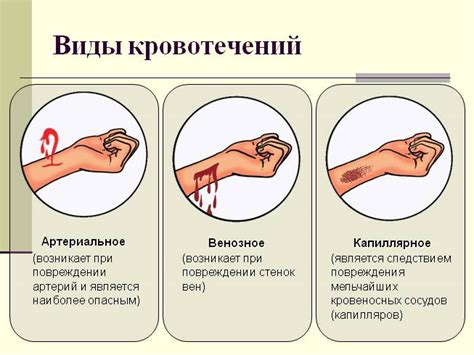 Сосудистые нарушения и кровотечение