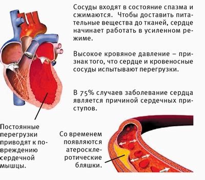 Сосуды сужены или расширены: как узнать?