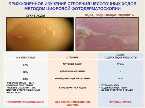 Способы профилактики чесотки стопы