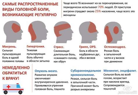 Способ 5: Улучшение подушки и матраса может помочь избавиться от боли в шее