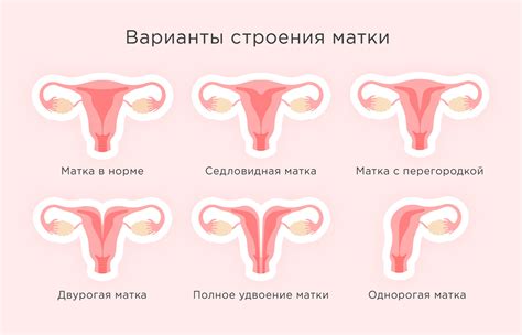 Строение влагалища и матки