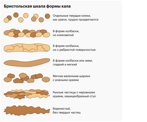 Типы агор