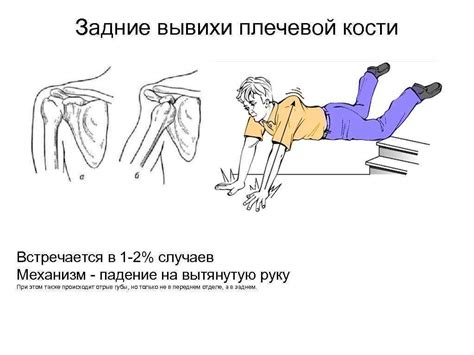 Травма при падении на вытянутую руку