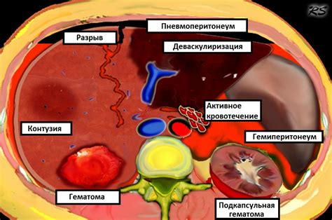 Травмы органов