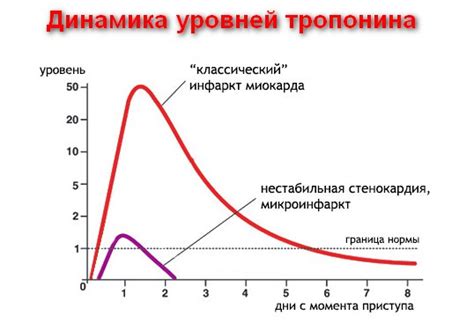 Тропонин и стенокардия: возможная связь
