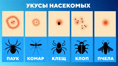 Укусы насекомых и чесание стопы: передача инфекций и противоэнтомологические меры