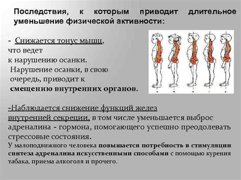 Уменьшение общей физической активности и ее последствия