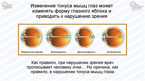 Ухудшение мускульного тонуса глаз