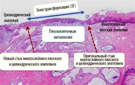 Факторы, влияющие на развитие многослойного плоского эпителия