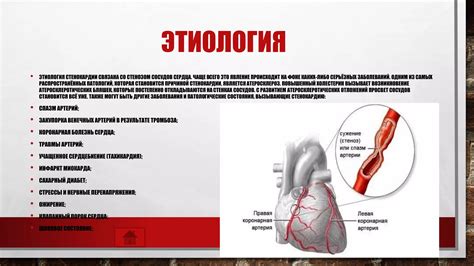 Факторы, возможно вызывающие стенокардию