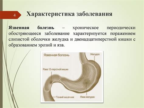 Факторы риска развития язвенной болезни с пенетрацией