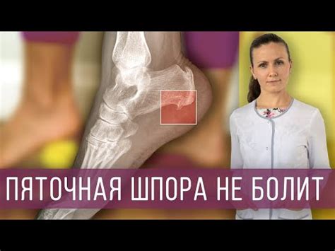 Фасциит стопы: симптомы и способы лечения