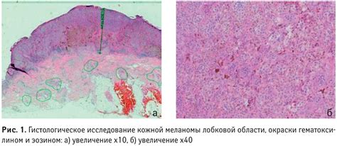 Физиология лобковой области