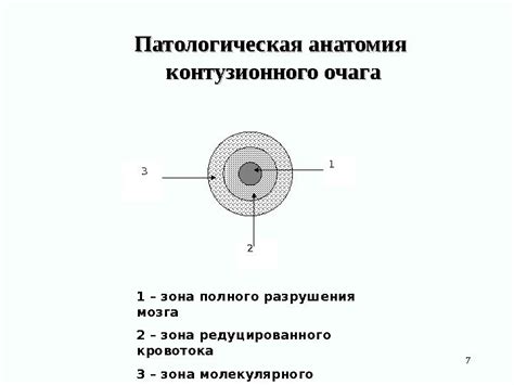 Физические проявления контузионного очага