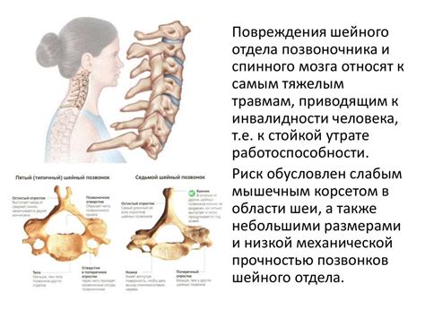 Функции СКТ шейного отдела позвоночника